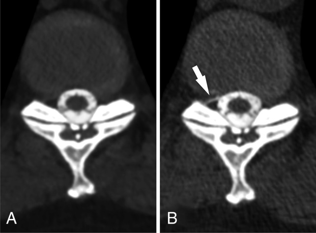 Fig 5.