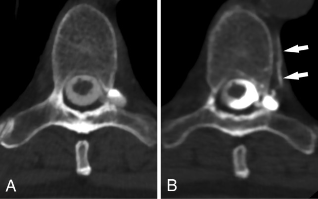 Fig 4.