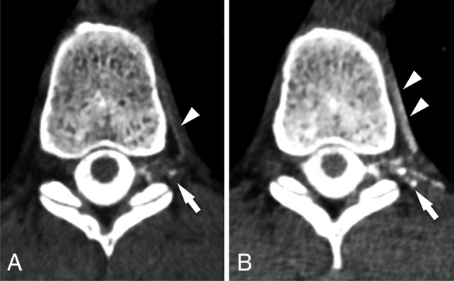 Fig 2.