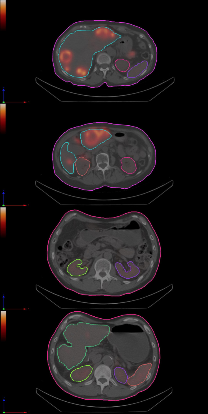 Fig. 3