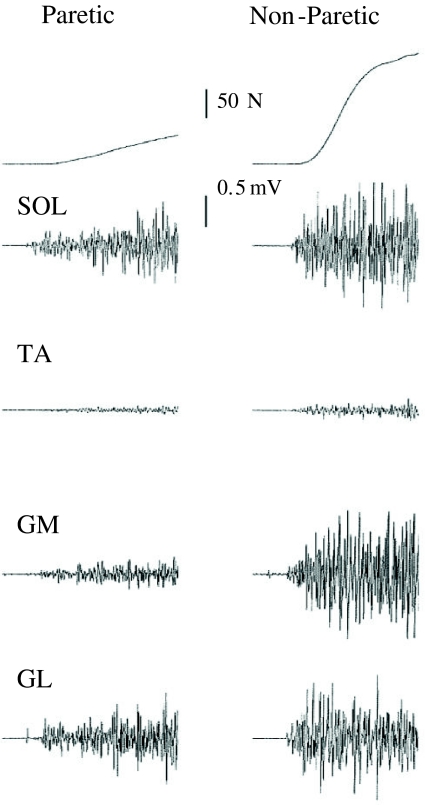 Fig. 4