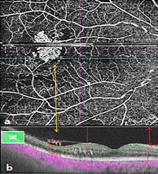 Fig.2