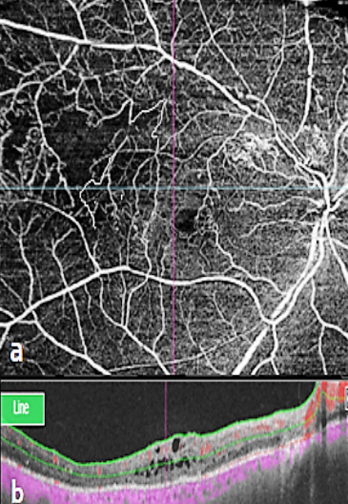 Fig.1