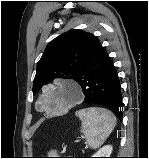 Figure 2.