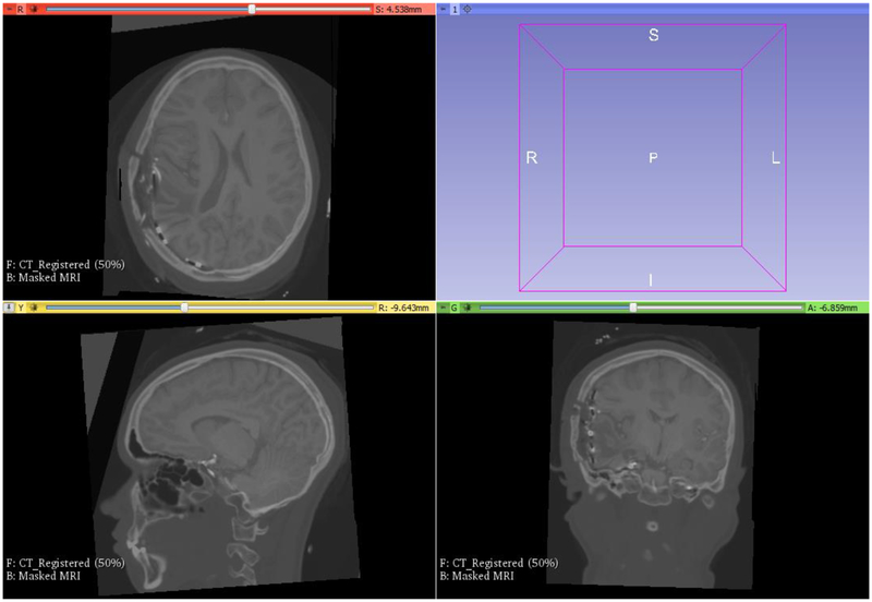 Figure 18: