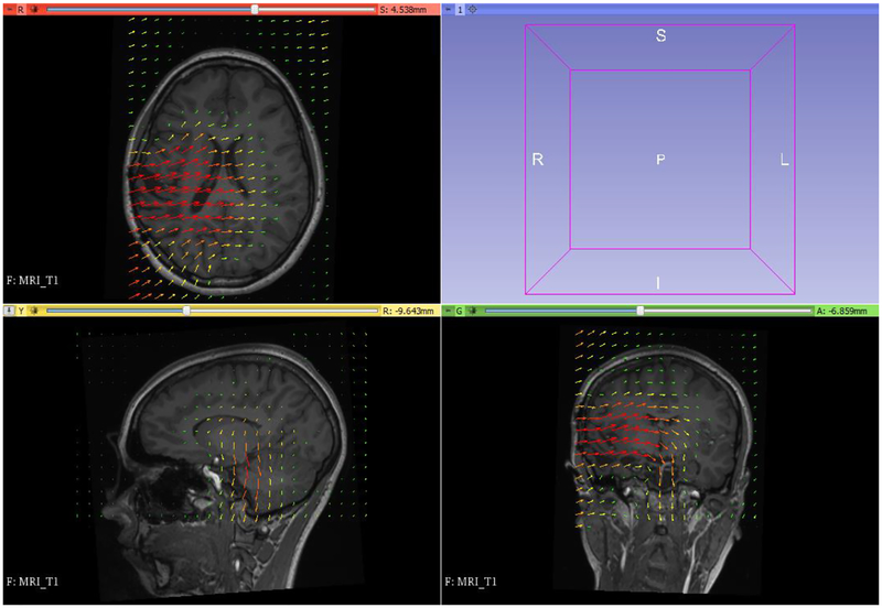 Figure 16: