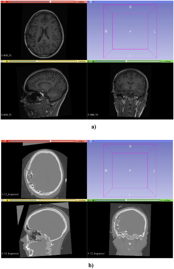 Figure 14: