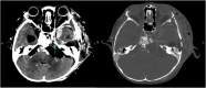 Fig 5