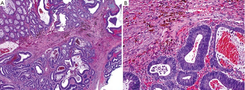 Figure 18