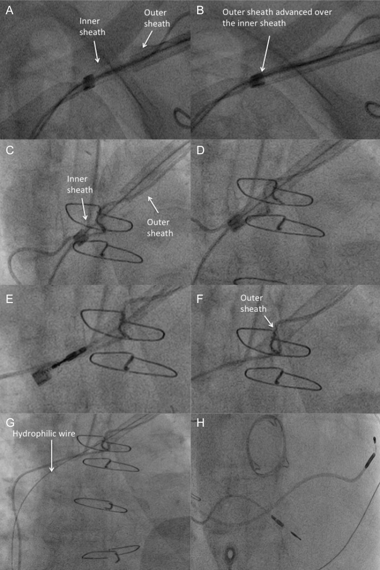 Figure 2