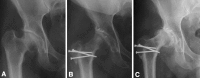 Fig. 6A–C
