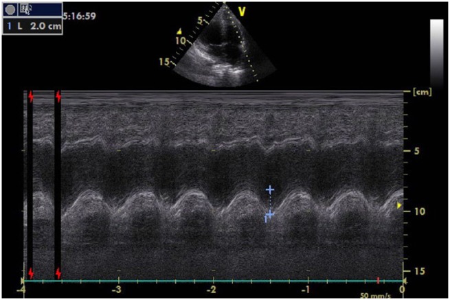 Figure 2.