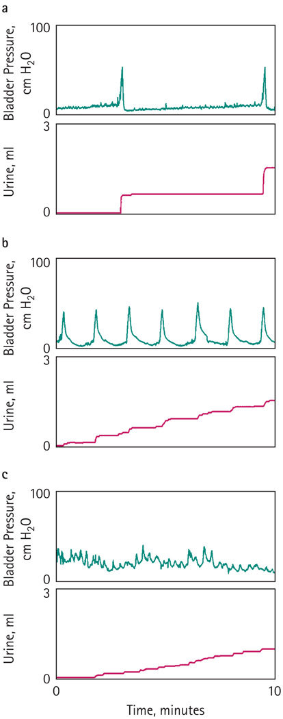 FIG. 1