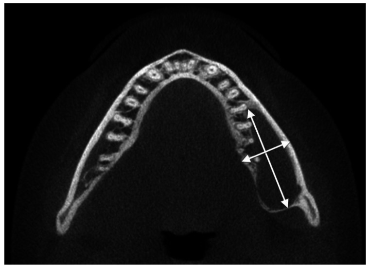 Fig. 2