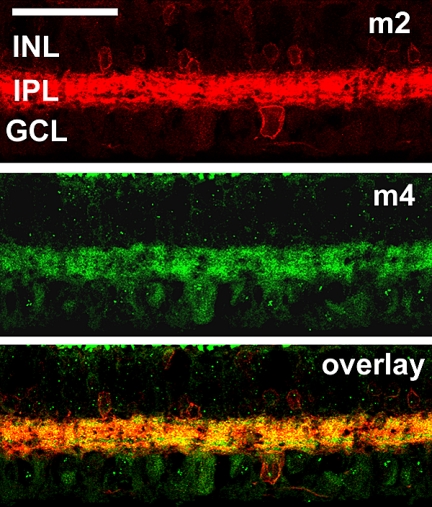 Figure 11.