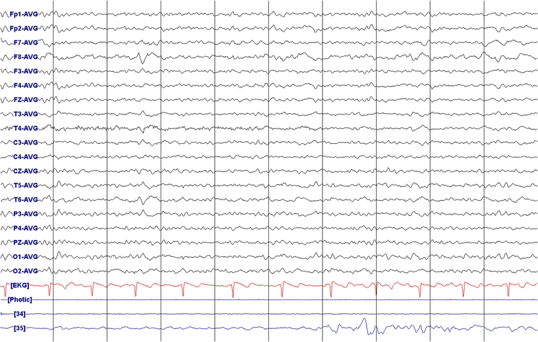 Fig. 2