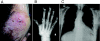 FIG. 1.