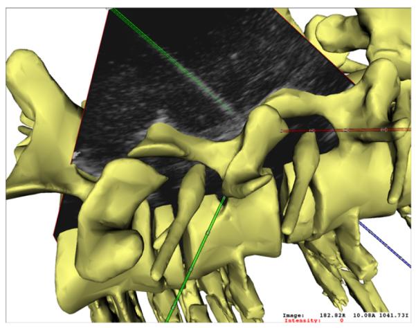 Fig. 11