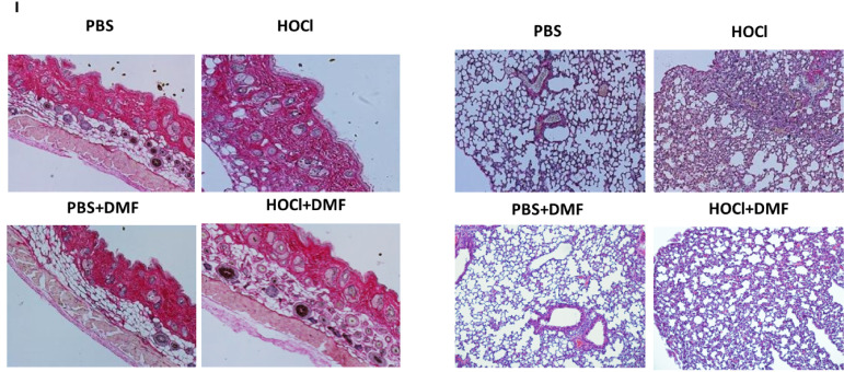 Figure 6I