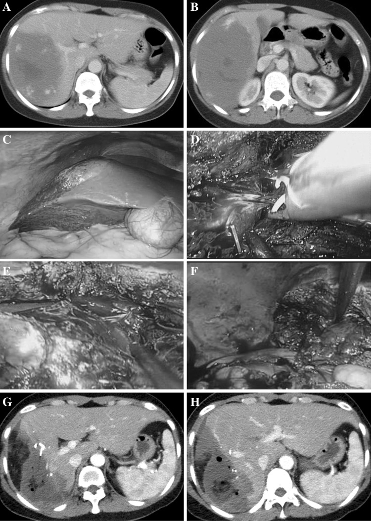 Fig. 2