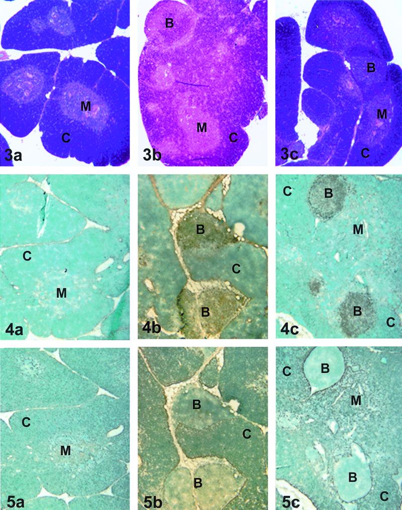 FIG. 3-5