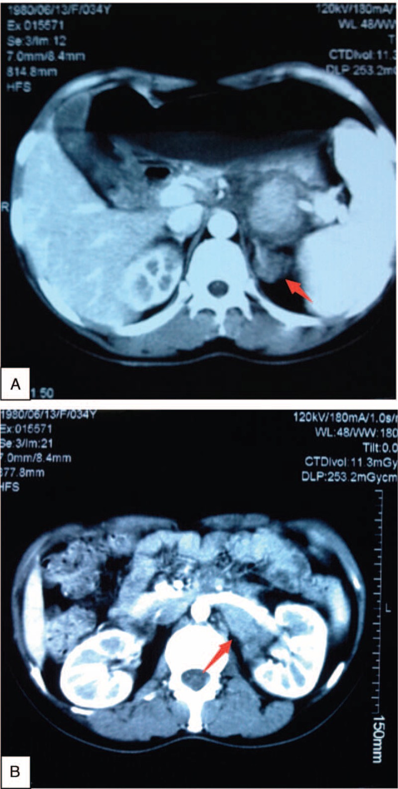 FIGURE 1