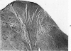 81