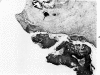 79