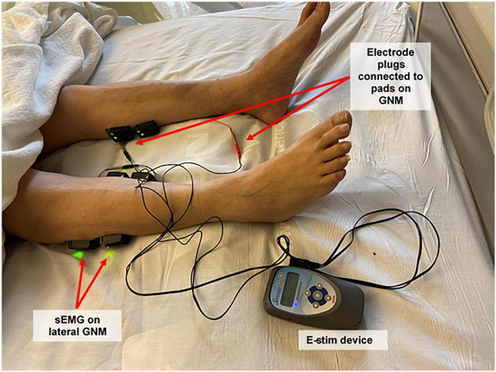 FIGURE 1