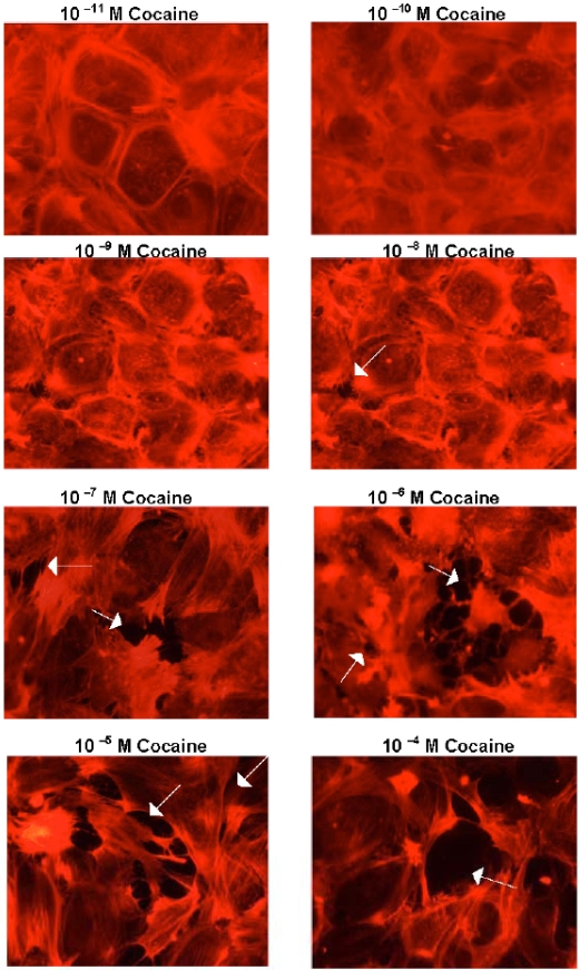 Fig. (1)