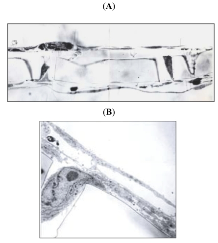 Fig. (3)