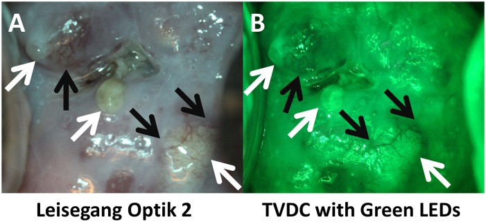 Fig 10