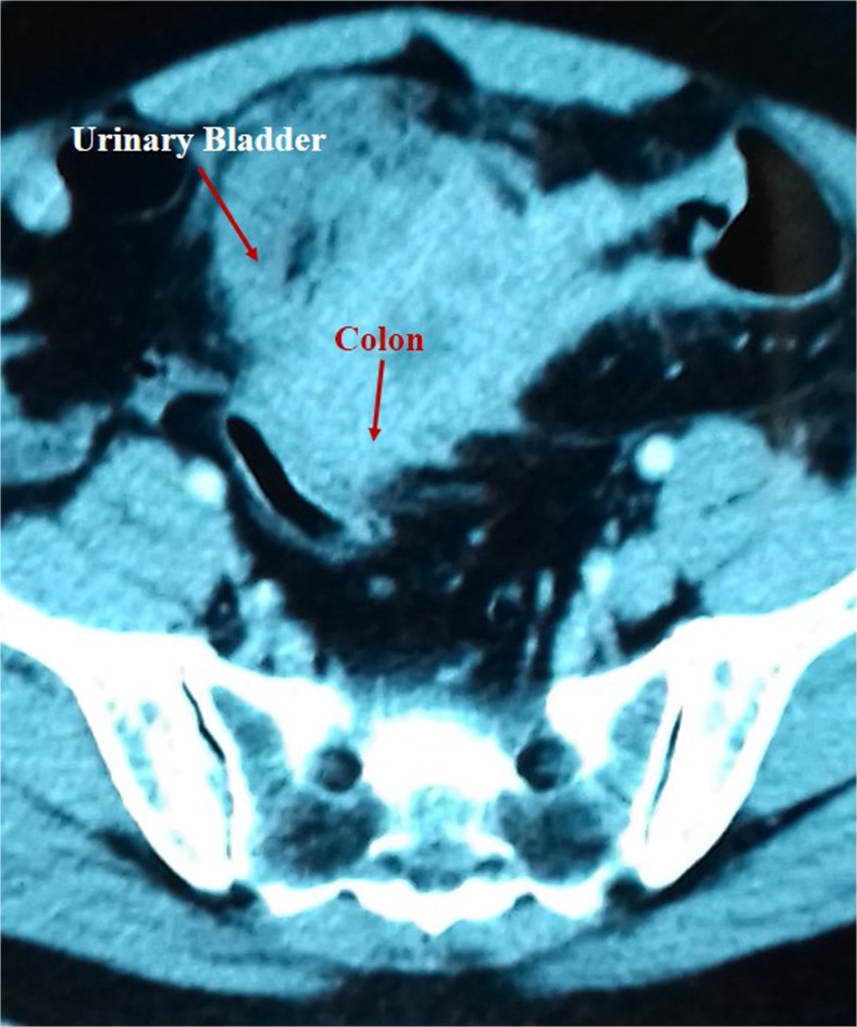 Fig. 2