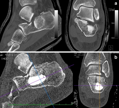 Fig. 5