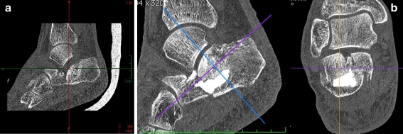 Fig. 3