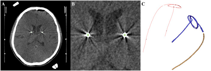 Fig 2