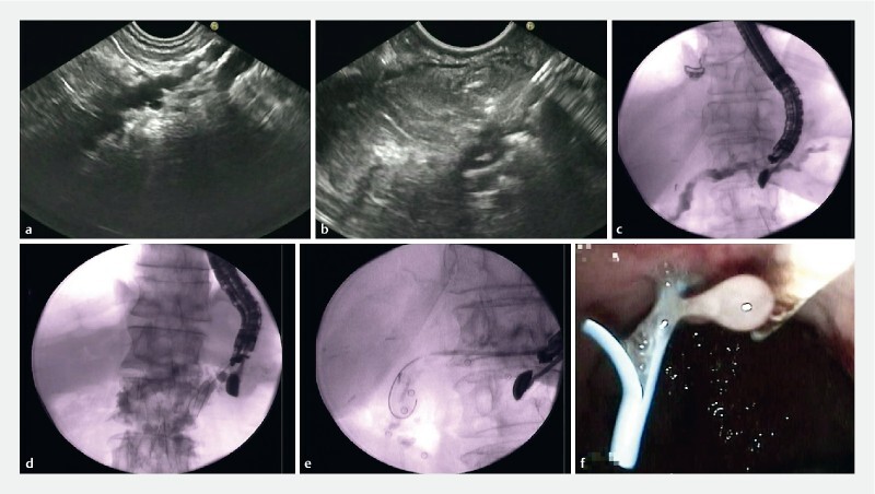 Fig. 2