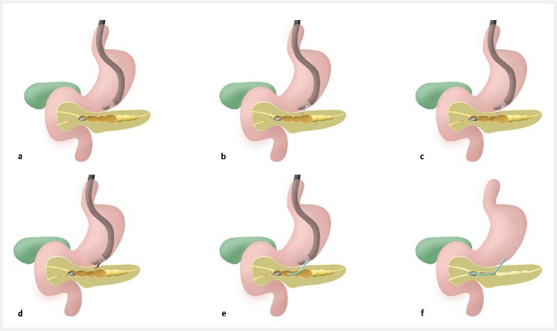 Fig. 1