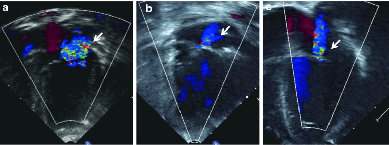 Fig. 2