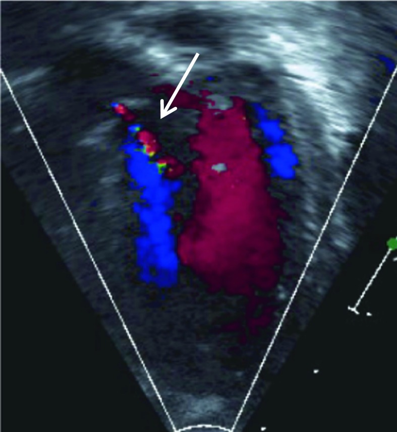 Fig. 4