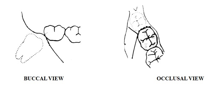 [Table/Fig-1]: