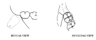 [Table/Fig-1]: