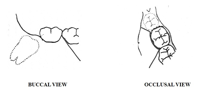 [Table/Fig-2]: