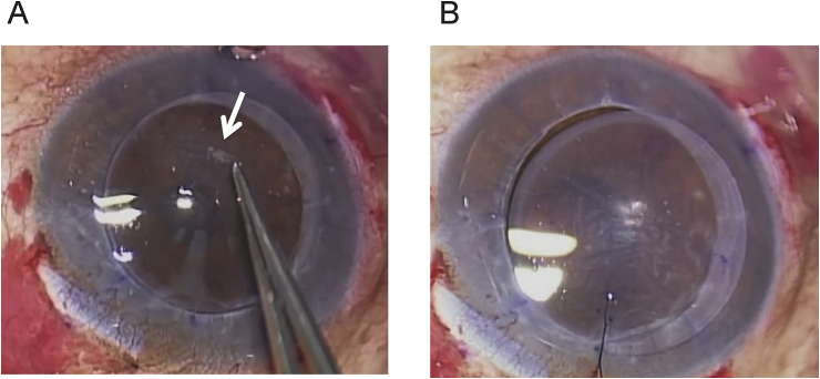 Fig. 1