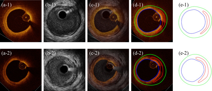 Fig. 3