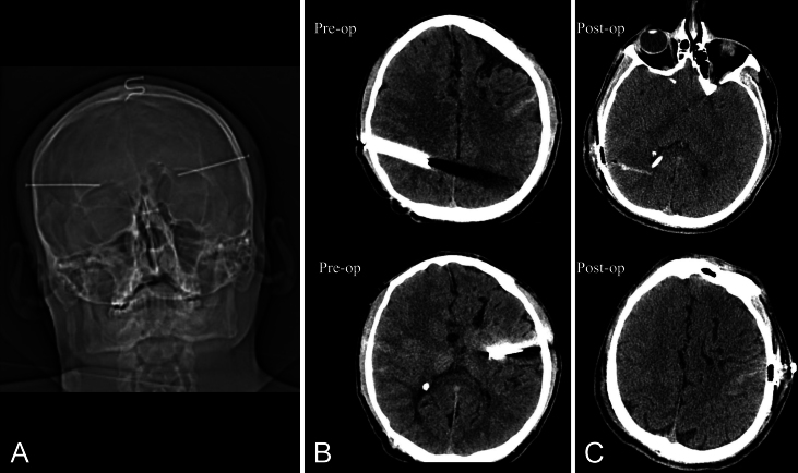 FIG. 3.