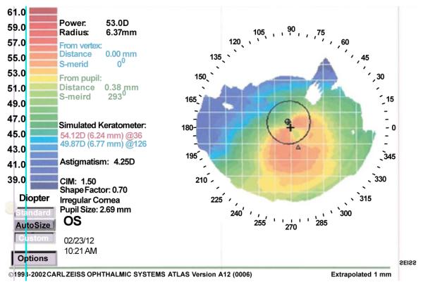 Figure 4