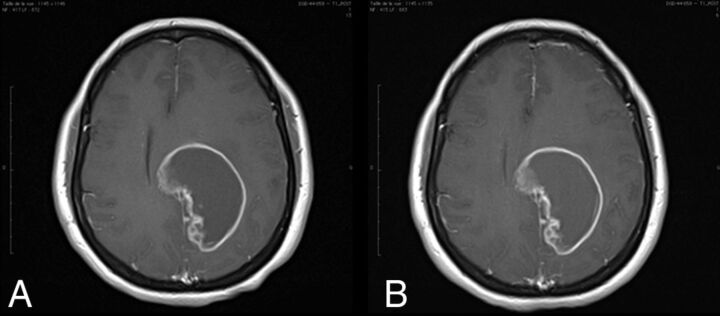 Fig 3.