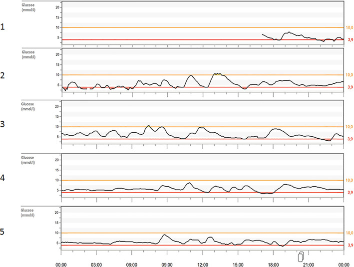 FIGURE 1