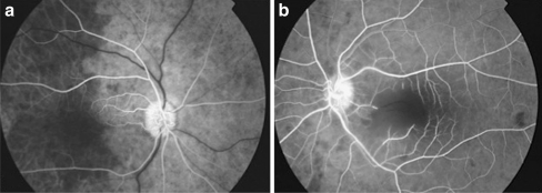 Fig. 3